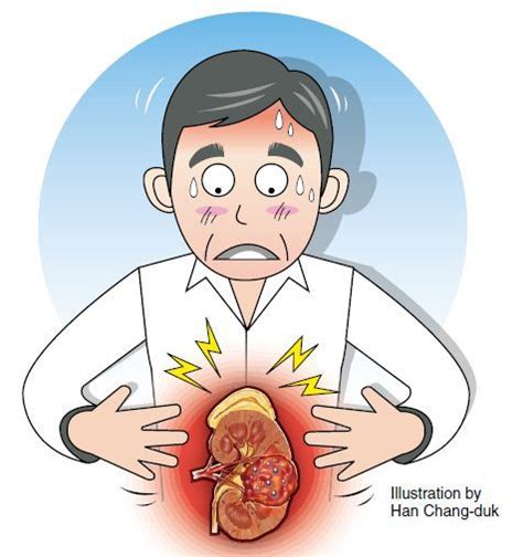 Symptoms: Kidney Cancer Symptoms