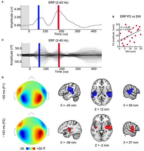 Frontiers Neural Correlates Of Early Sound Encoding And Their