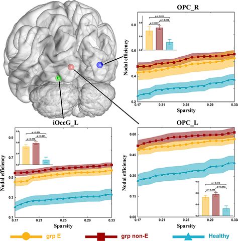 Frontiers Epilepsy Related Brain Network Alterations In Patients With