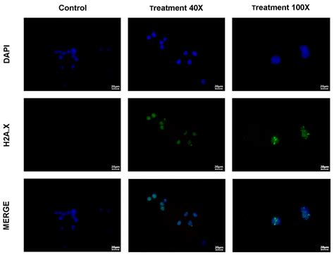 Ijms Free Full Text Ac Ipsma Rgd For Alpha Therapy Dual