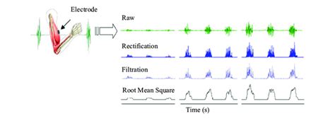 Different techniques for EMG signal processing | Download Scientific ...