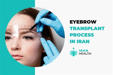 Eyebrow Transplant In Iran Affordable Cost Best Surgeons And Modern