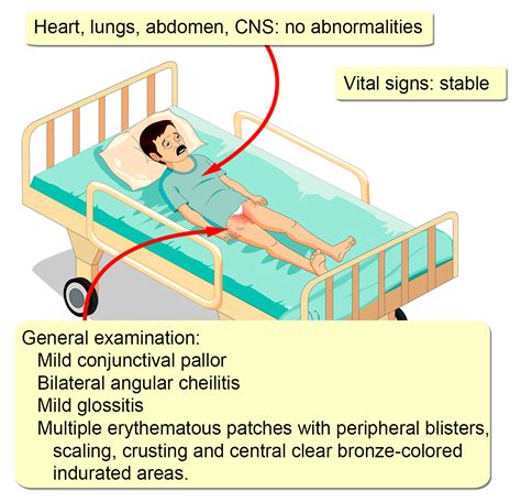 Glucagonoma - Interactive case study | Clinical Odyssey by Medical ...