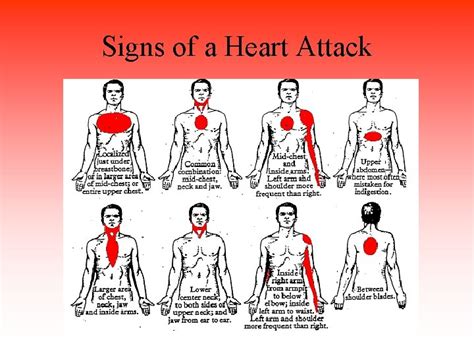 Cardiovascular Disease By Tina Bobek R N Risk