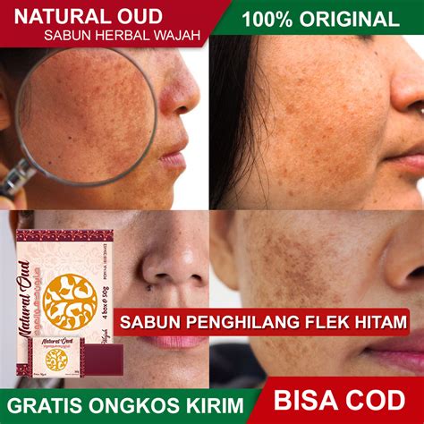 Produk Hilangkan Bintik Hitam Di Hidung Emily Bower