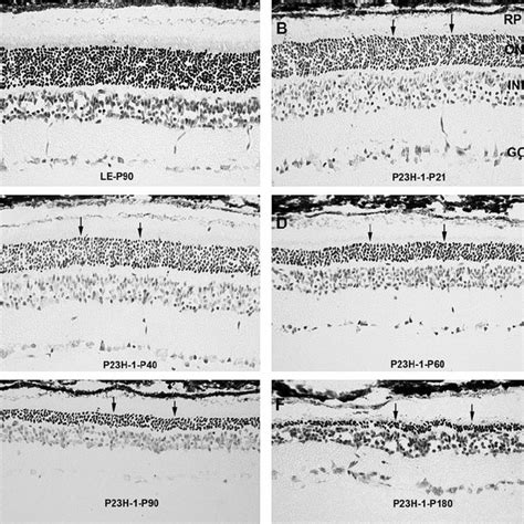 Retinal Sections Stained With Cresyl Violet A Normal Control LE