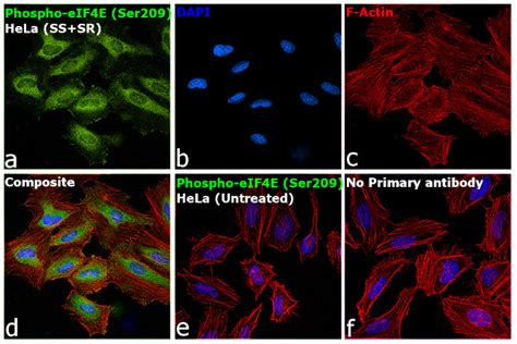 Phospho Eif4e Ser209 Polyclonal Antibody Pa5 17919