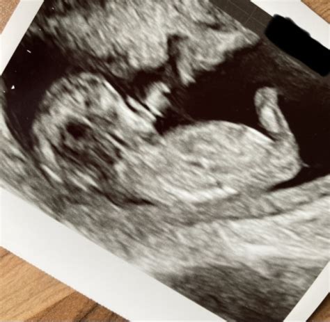 12 Week Scan Any Gender Guesses Mumsnet