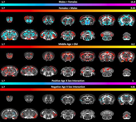 Morphometric Differences In Sex And Age Of Apoe2 Targeted Replacement