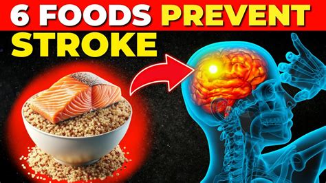 6 Foods To Prevent Stroke And Recover From Stroke Stroke Prevention Youtube