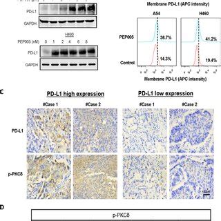 Pkc Enhanced Pd L Expression And Induced Immune Escape A Pkc