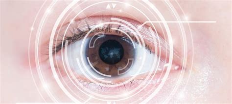 ¿operación Lasik O Prk Clínica Oftalmológica Madrid