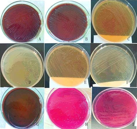 Growth Of Bacteria On Different Media And Colony Morphology Following Download Scientific