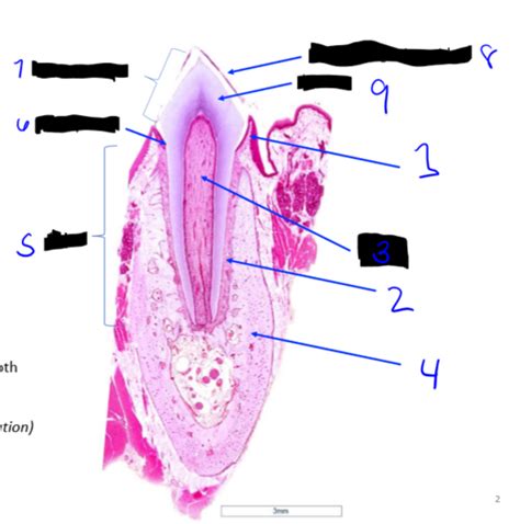 Histo Exam Digestive Lab Flashcards Quizlet