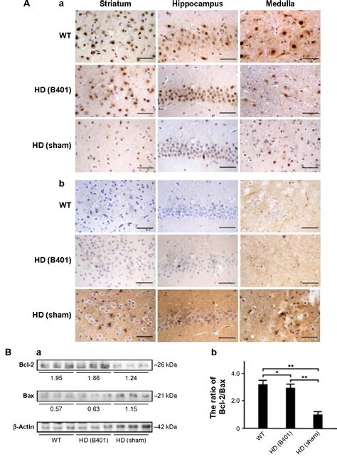 Figure 8 From Clinical Interventions In Aging Dovepress Oral Treatment