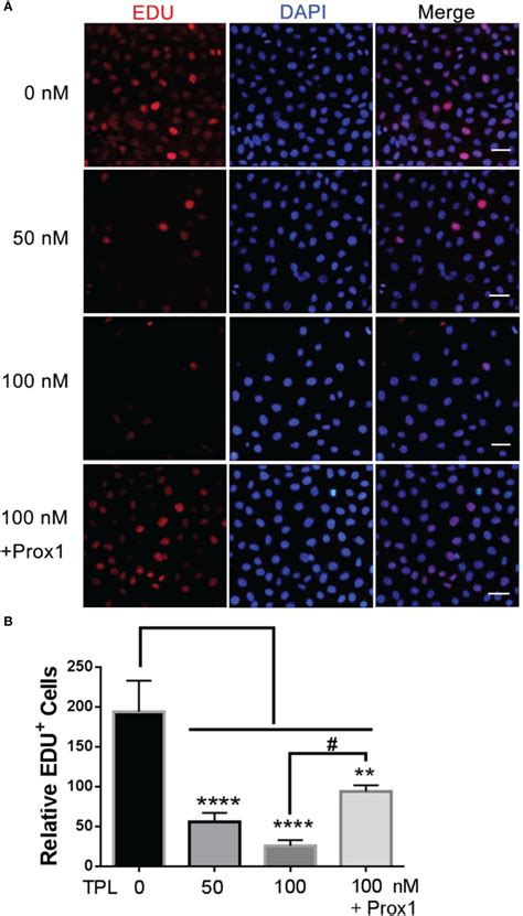 Frontiers Triptolide Inhibits The Progression Of Glioblastoma U251