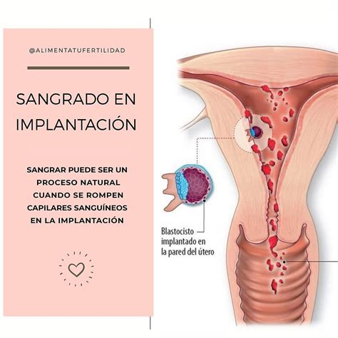 Sangrado En La Implantaci N Y Desarrollo Embrionario