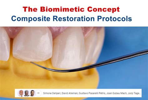 The Biomimetic Concept Composite Restoration Protocols Dental Videos