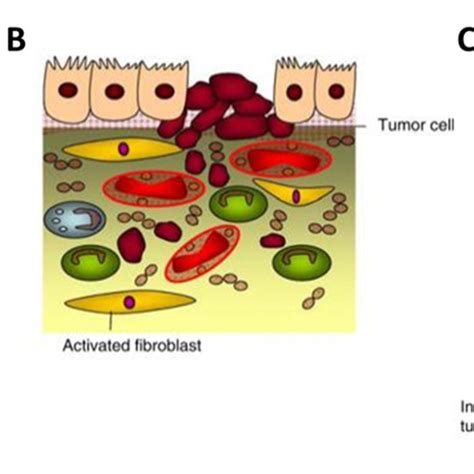 Schematic Representation Of The Tumor Microenvironment Tme Depicting