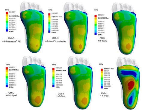 Applied Sciences Free Full Text The Effect Of Customized Insole