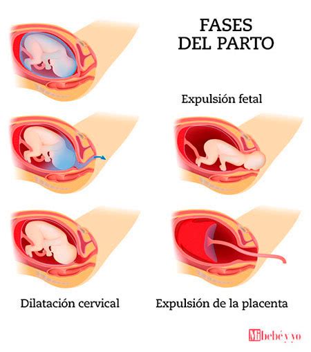 Imagenes Que Recopilan Las Fases Del Parto Fotos Especificas Porn Sex