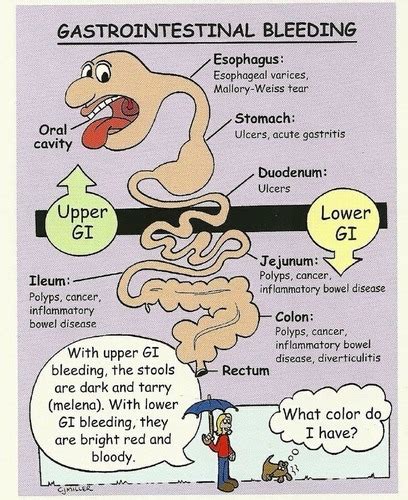 CCRN Review Gastrointestinal Flashcards Quizlet