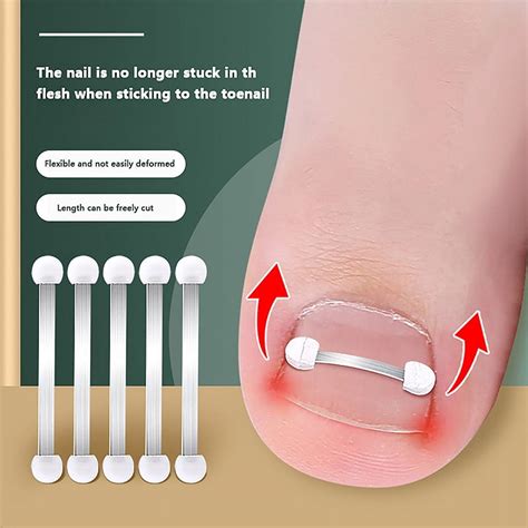 Ingrown Toenail Corrector Tools Pedicure Recover Embed Toe Nail