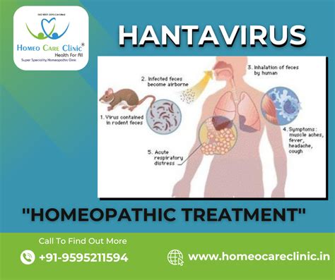 Hantavirus pulmonary syndrome: Symptoms and Treatment