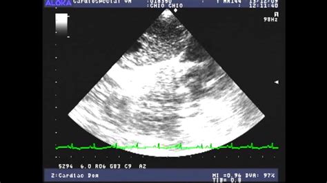 Heartworm Disease Echocardiography Youtube