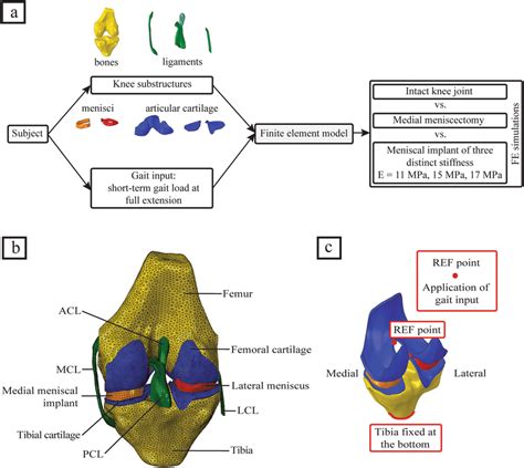 A Study Workflow B D Finite Element Model Of The Human Knee Joint