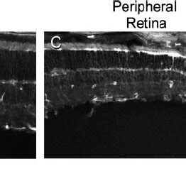 Collage Of Confocal Micrographs Of 2 Label In An Adult Mouse Retina