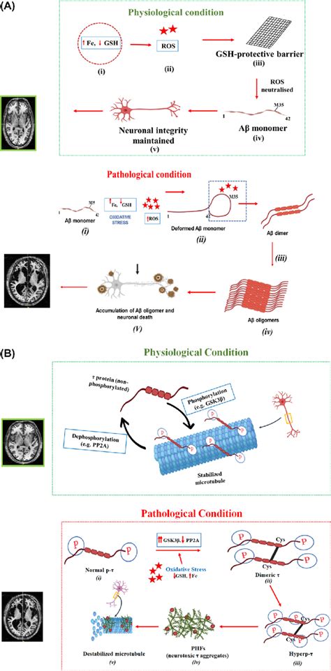 Model Highlighting The Impact Of Os On Amyloid Plaque Formation And Tau