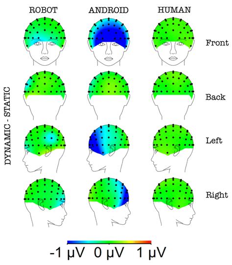 3 Erp Scalp Maps Representing The Difference Between Static And