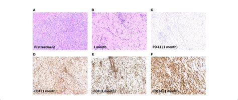 Pathologic And Immunohistochemical Assessment Of Response A