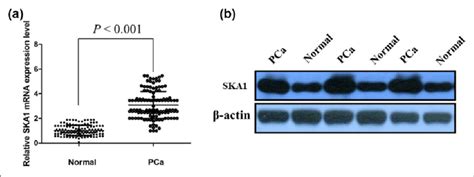 A Qrt Pcr Showing Expression Level Of Ska Mrna In Pca Tissues B