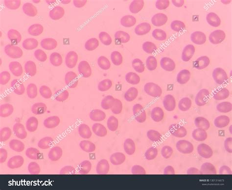 ภาพ ภาพสต็อก วัตถุ 3 มิติและเวกเตอร์เกี่ยวกับ Theta Cell Hematology 2 รายการ Shutterstock