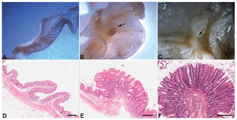 Appearance Of Normal Colonic Mucosa And Tumors Colonic Polyps In The Download Scientific