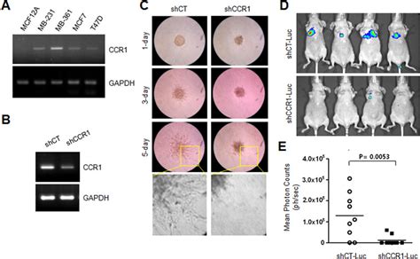 Effect Of Ccr1 Silencing On Experimental Tumor Invasion And Metastasis