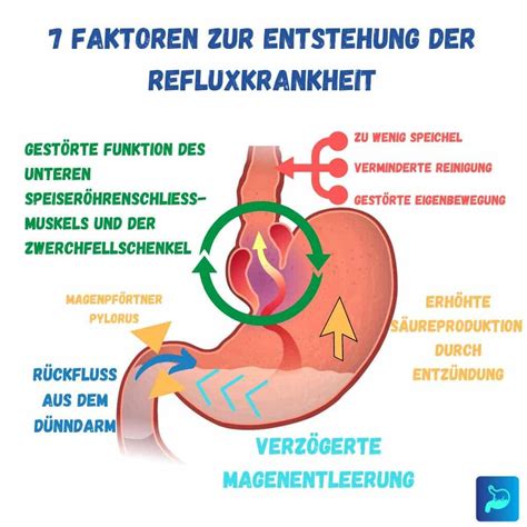 Refluxkrankheit Wenn Sodbrennen Krankheitswert Bekommt