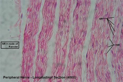 Peripheral Nerve Histology Nodes Of Ranvier