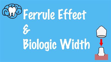 Ferrule Effect And Biologic Width Youtube