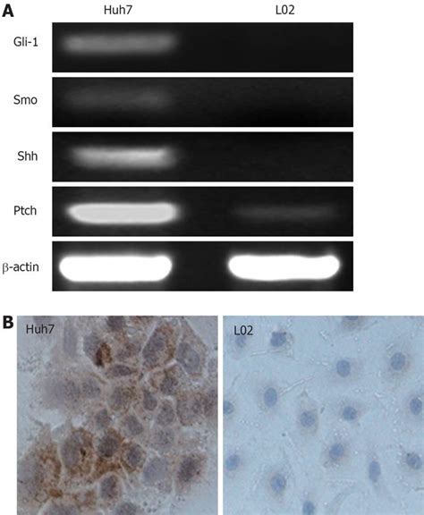 Gli 1 Sirna Induced Apoptosis In Huh7 Cells