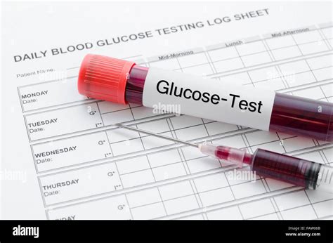 Daily Blood Glucose Testing And Sample Blood In Tube And Syringe Blood