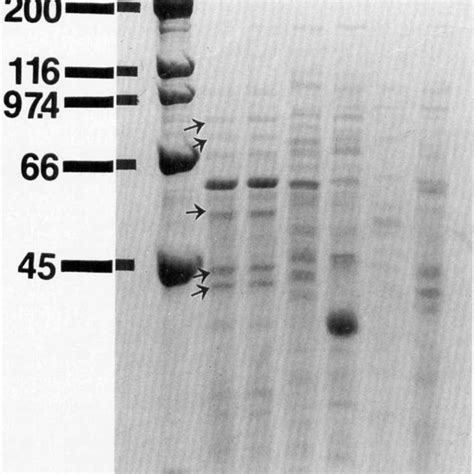 Sds Page Profiles Of Soluble Proteins From Strain B Lane S