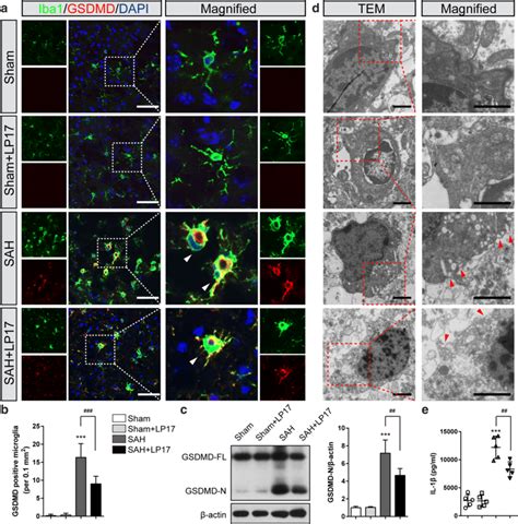 Suppression Of Trem Suppressed Microglial Pyroptosis Following Sah