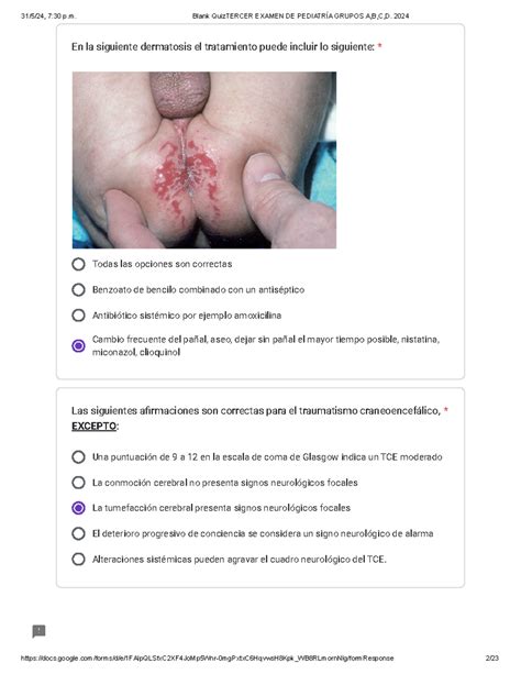 Examen Pediatria 3 Parcial Todas Las Opciones Son Correctas Benzoato