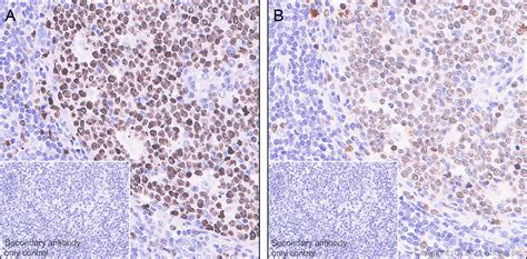 Anti Ki67 Antibody SP6 AB16667 Abcam India