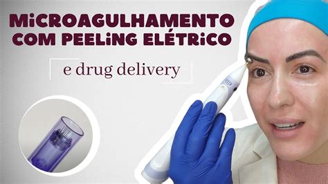 Microagulhamento Peeling El Trico E Drug Delivery Youtube