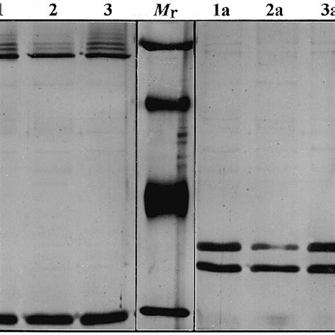 Sds Polyacrylamide Gel Electrophoresis Analysis Of The Outer Membrane Download Scientific