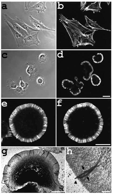 Lamellipodia Formation Was Induced In 3y1 Cells On Poly Llysine Cells